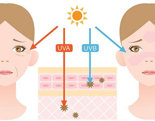 UVA lúče prenikajú hlboko do pokožky a spôsobujú dlhodobé poškodenie, ktoré sa odrazí napríklad na skorých vráskach. UVB lúče neprenikajú tak hlboko a spôsobujú predovšetkým vonkajšie poškodenie pokožky, akým je začervenanie.