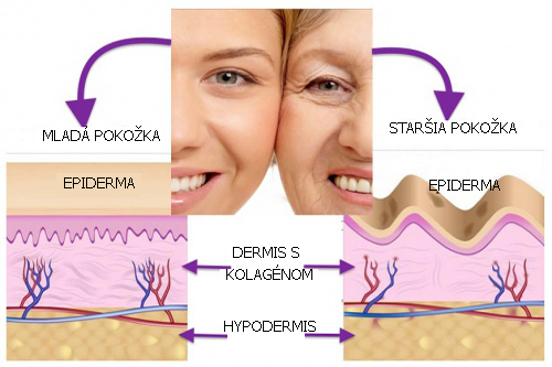 Starnúca pleť stráca kolagén a nadobúda vrásky.