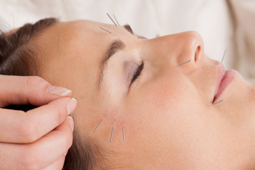 Akupunktúra nemôže uškodiť, ale môže vyliečiť.
