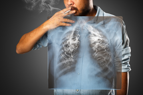 Hoci si myslíme, že fajčenie škodí iba pľúcam, pravda je ešte oveľa zdrvujúcejšia.