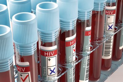 HIV - vírus ľudskej imunitnej nedostatočnosti