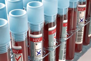 HIV - vírus ľudskej imunitnej nedostatočnosti