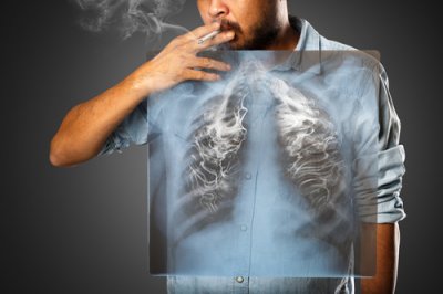 Ako vyzerajú ľudské pľúca po jednom balíčku cigariet?