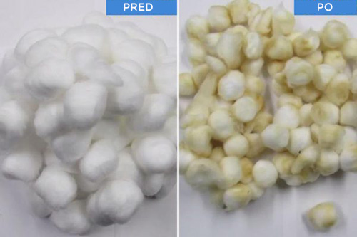 Porovnanie bavlnených guľočok pred a po experimente.