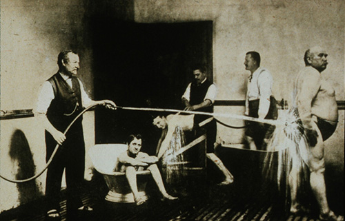 Kneipp predpisoval rôzne procedúry vrátane sedavých kúpeľov, studených obkladov, kúpeľov rúk, nôh či hlavy.